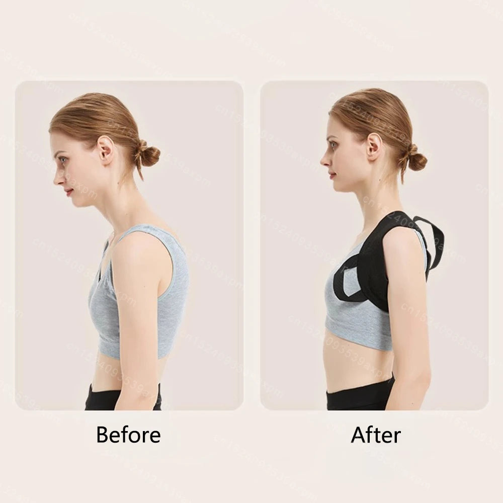 Zoechic Adjustable Back Posture Corrector Belt Unisex Support