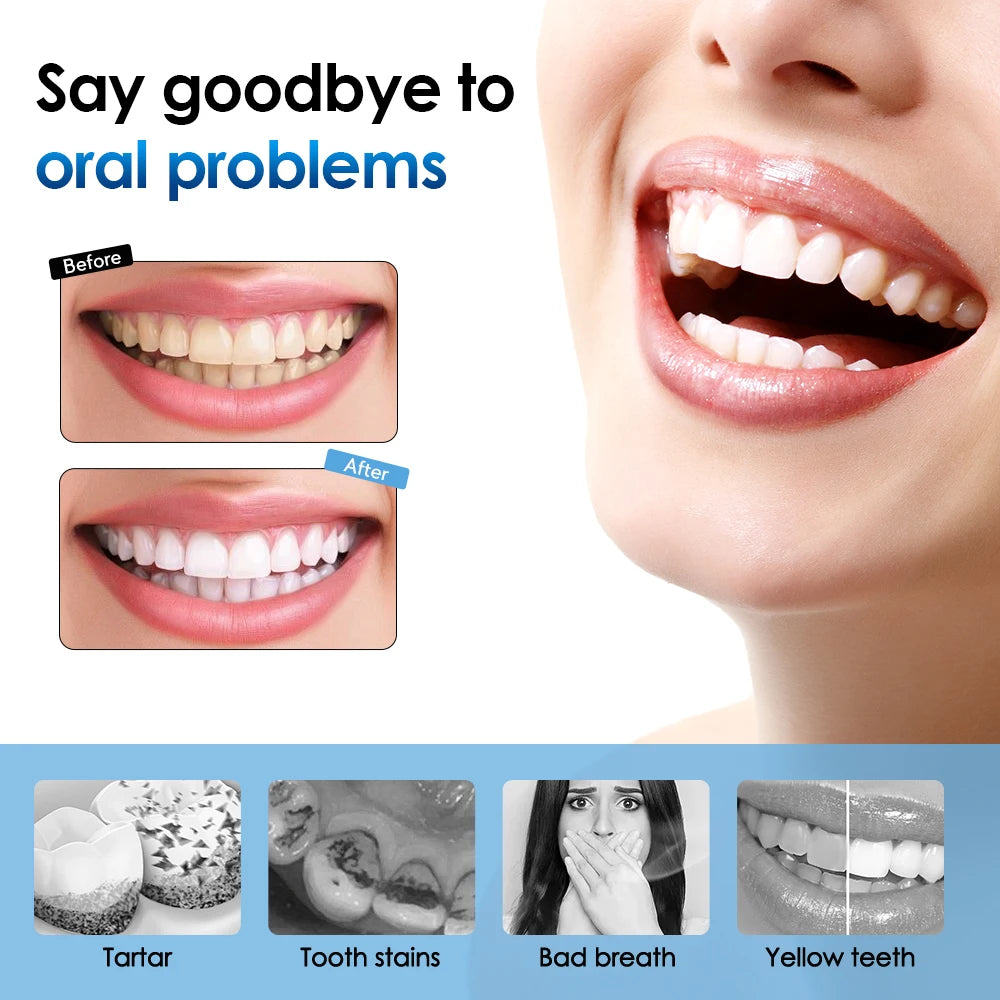 AFDEAL Electric Sonic Toothbrush For Plaque And Coffee Stains Whitening